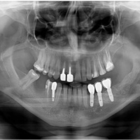 Chirurgia stomatologia Radom