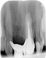 Endodoncja Radom ul. Zakręt 6