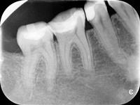 Endodoncja Radom ul. Zakręt 6