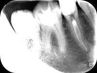 Endodoncja Radom ul. Zakręt 6