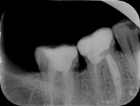 Endodoncja Radom ul. Zakręt 6