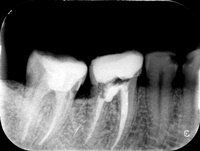 Endodoncja Radom ul. Zakręt 6