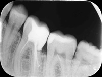 Endodoncja Radom ul. Zakręt 6