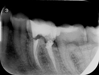 Endodoncja Radom ul. Zakręt 6