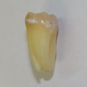 Endodoncja Radom